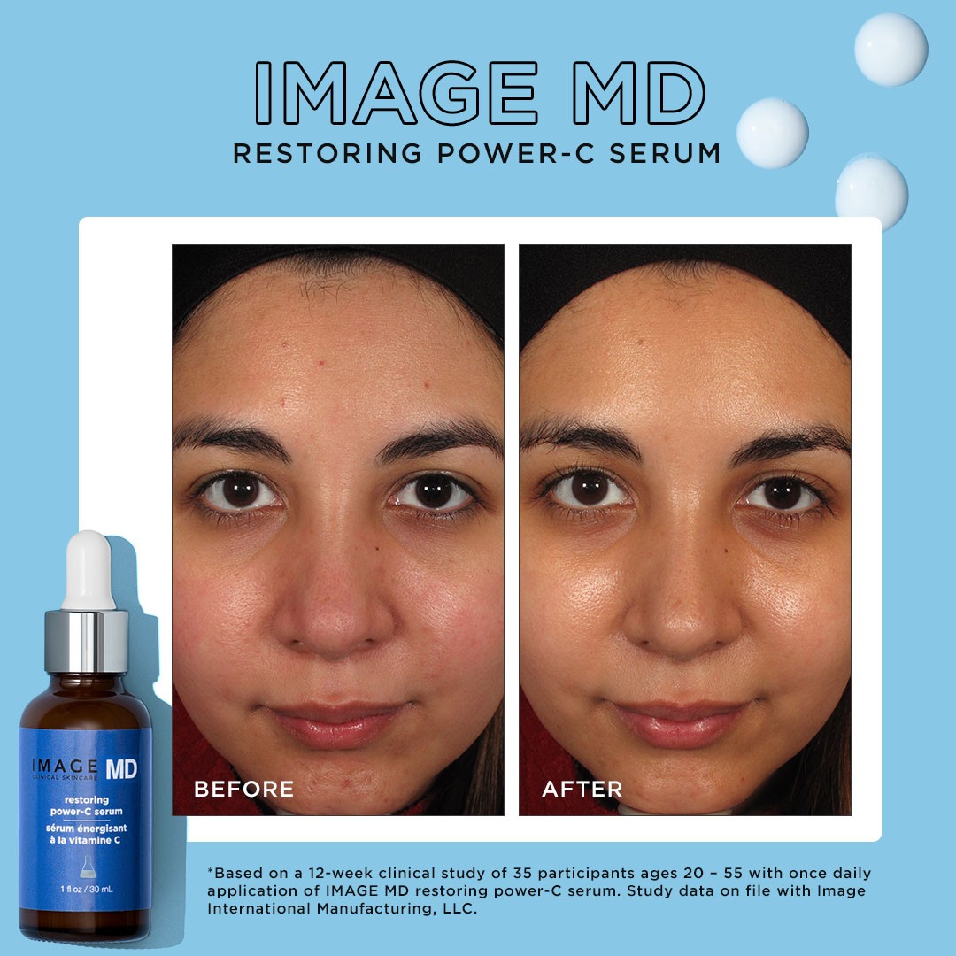 image-md-restoring-power-c-serum-pdp-r08-1.jpg