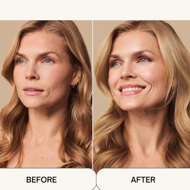 beforeandafter5web.jpg
