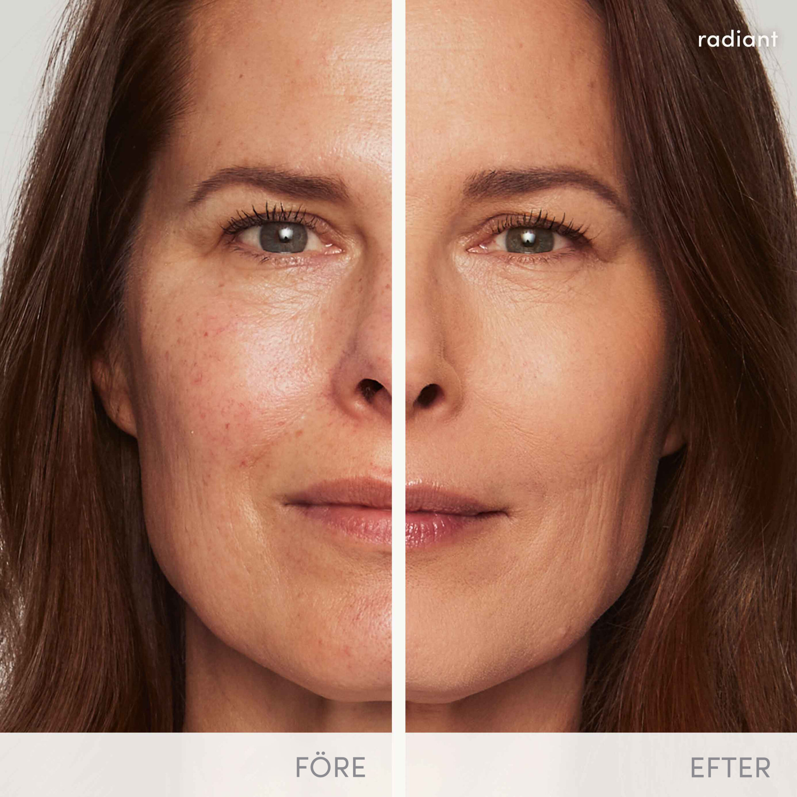 ForeEfter Radiant - PurePressed-Base