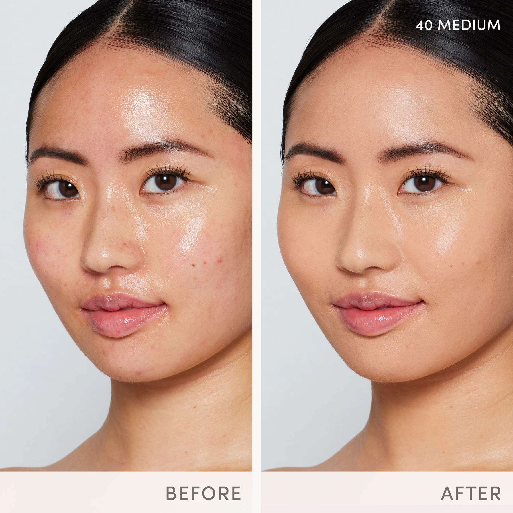 Skintuition_BAs_Medium_40